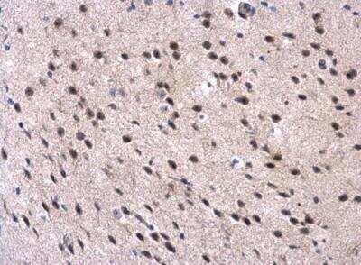 Immunohistochemistry-Paraffin: MPP3 Antibody [NBP1-32669]