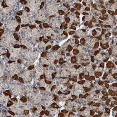 Immunohistochemistry-Paraffin: MPP3 Antibody [NBP1-85014]