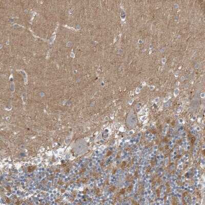 Immunohistochemistry-Paraffin: MPP3 Antibody [NBP1-85014]