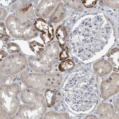 Immunohistochemistry-Paraffin: MPP3 Antibody [NBP1-85014]