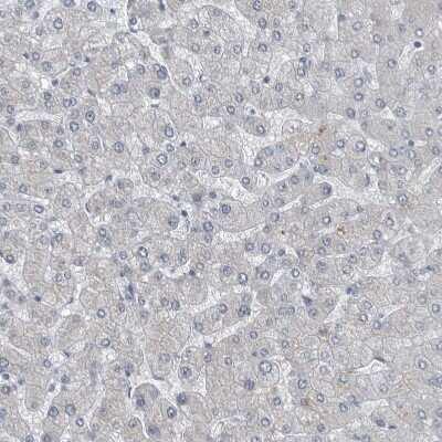 Immunohistochemistry-Paraffin: MPP3 Antibody [NBP1-85014]
