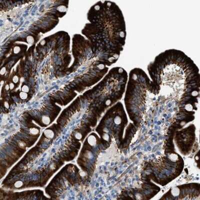 Immunohistochemistry-Paraffin: MPP3 Antibody [NBP1-85015]