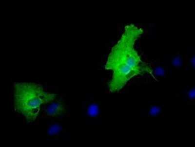 Immunocytochemistry/ Immunofluorescence: MPP3 Antibody (OTI8F1) - Azide and BSA Free [NBP2-72771]