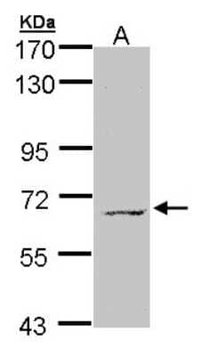 Western Blot: MPP3 Antibody [NBP1-32669]