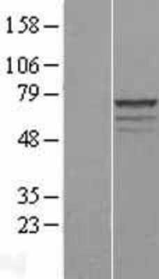 Western Blot: MPP3 Overexpression Lysate [NBL1-13204]