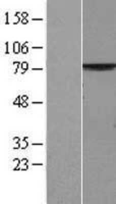 Western Blot: PALS1/MPP5 Overexpression Lysate [NBP2-06432]