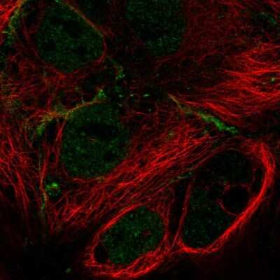 Immunocytochemistry/ Immunofluorescence: MPP7 Antibody [NBP2-58527]