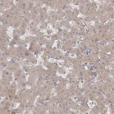 Immunohistochemistry-Paraffin: MPP7 Antibody [NBP1-81989]
