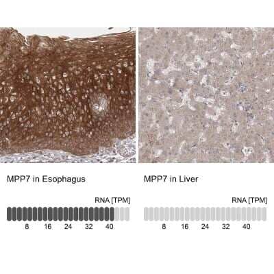 Immunohistochemistry-Paraffin: MPP7 Antibody [NBP1-81989]