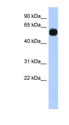 Western Blot: MPP7 Antibody [NBP1-53081]