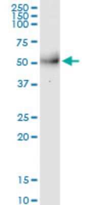 Western Blot: MPPE1 Antibody (3E4) [H00065258-M08]