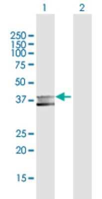 Western Blot: MPPE1 Antibody [H00065258-D01P]