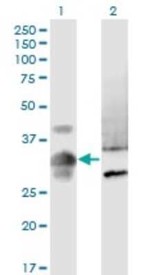 Western Blot: MPPED2 Antibody (4H5) [H00000744-M08]