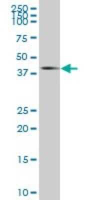 Western Blot: MPPED2 Antibody [H00000744-B01P]