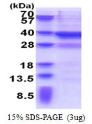 SDS-PAGE: Recombinant Human MPPED2 His Protein [NBP2-23229]