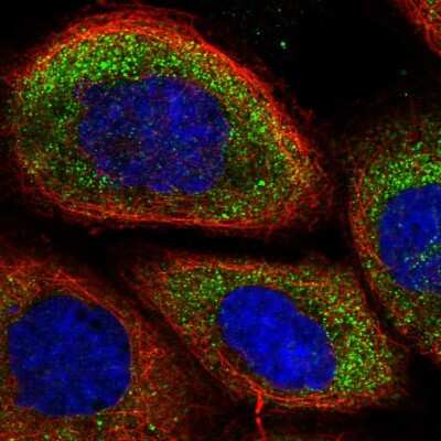 Immunocytochemistry/ Immunofluorescence: MPRA Antibody [NBP2-13731]