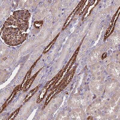 Immunohistochemistry-Paraffin: MPRA Antibody [NBP2-13731]