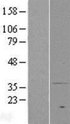 Western Blot: MPRA Overexpression Lysate [NBP2-04977]