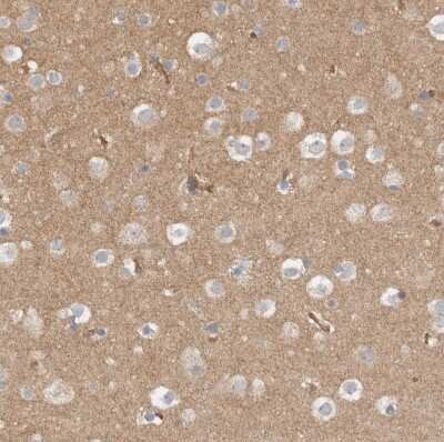 Immunohistochemistry-Paraffin: MPRIP Antibody [NBP1-81035]