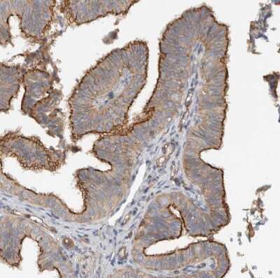 Immunohistochemistry-Paraffin: MPRIP Antibody [NBP1-81035]