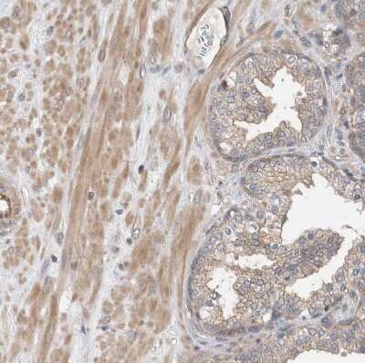 Immunohistochemistry-Paraffin: MPRIP Antibody [NBP1-81035]