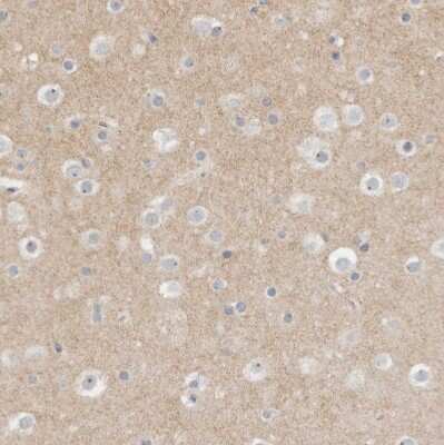 Immunohistochemistry-Paraffin: MPRIP Antibody [NBP1-81036]