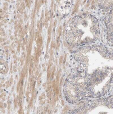 Immunohistochemistry-Paraffin: MPRIP Antibody [NBP1-81036]