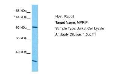 Western Blot: MPRIP Antibody [NBP2-85309]