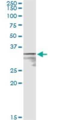 Immunoprecipitation: MPST Antibody (1B5) [H00004357-M01]