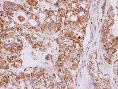 Immunohistochemistry-Paraffin: MPST Antibody [NBP1-31115]