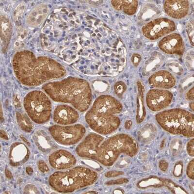 Immunohistochemistry-Paraffin: MPST Antibody [NBP1-82617]