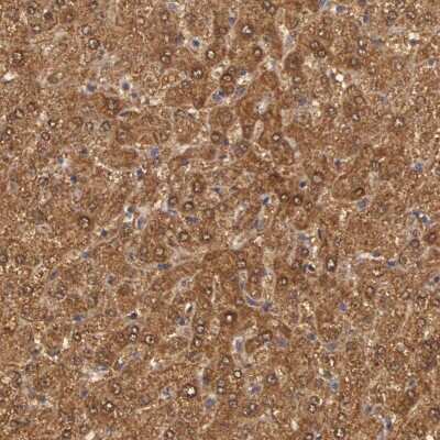 Immunohistochemistry-Paraffin: MPST Antibody [NBP1-82617]