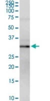 Western Blot: MPST Antibody [H00004357-D01P]