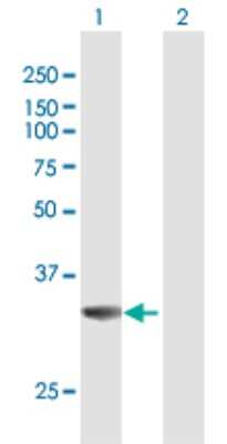 Western Blot: MPST Antibody [H00004357-D01P]