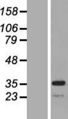 Western Blot: MPST Overexpression Lysate [NBL1-13209]