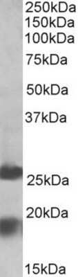 Western Blot: MPV17 Antibody [NBP1-52097]