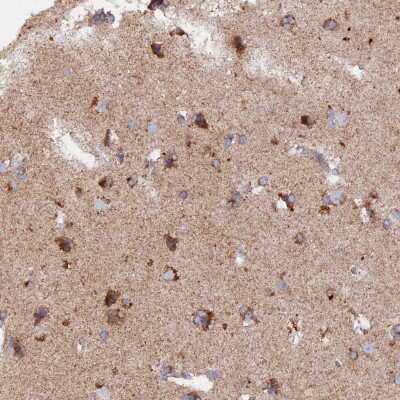 Immunohistochemistry-Paraffin: MPV17L Antibody [NBP1-83466]
