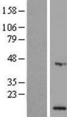 Western Blot: MPV17L Overexpression Lysate [NBL1-13212]