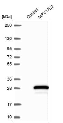 Western Blot: MPV17L2 Antibody [NBP1-84668]