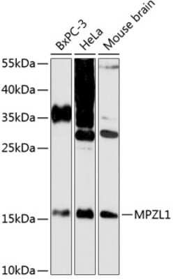 Western Blot: MPZL1 AntibodyAzide and BSA Free [NBP2-93845]