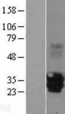 Western Blot: EVA1/MPZL2 Overexpression Lysate [NBL1-13215]