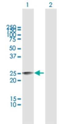 Western Blot: MPZL3 Antibody [H00196264-B01P]