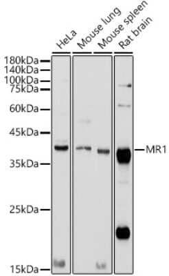 Western Blot: MR1 AntibodyAzide and BSA Free [NBP2-93753]