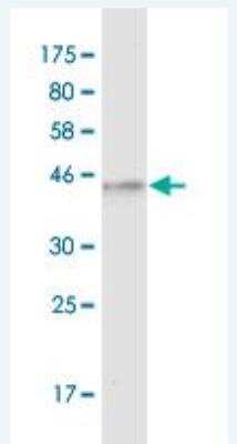 Western Blot: MR1 Antibody (5B5) [H00003140-M04]