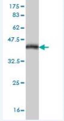 Western Blot: MR1 Antibody (5E9) [H00003140-M03]