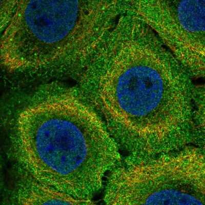 Immunocytochemistry/ Immunofluorescence: MR1 Antibody [NBP2-57625]