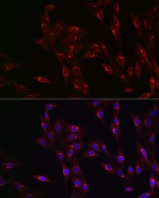 Immunocytochemistry/ Immunofluorescence: MR1 Antibody - Azide and BSA Free [NBP2-93753]