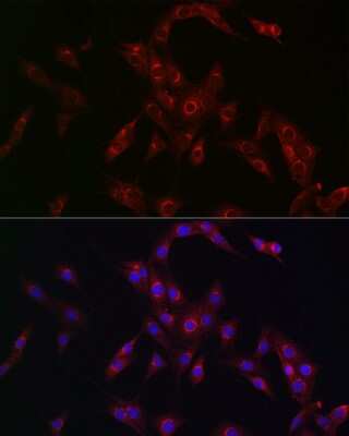 Immunocytochemistry/ Immunofluorescence: MR1 Antibody - Azide and BSA Free [NBP2-93753]