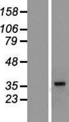 Western Blot: MR1 Overexpression Lysate [NBP2-08196]