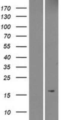 Western Blot: MRAP Overexpression Lysate [NBP2-04518]